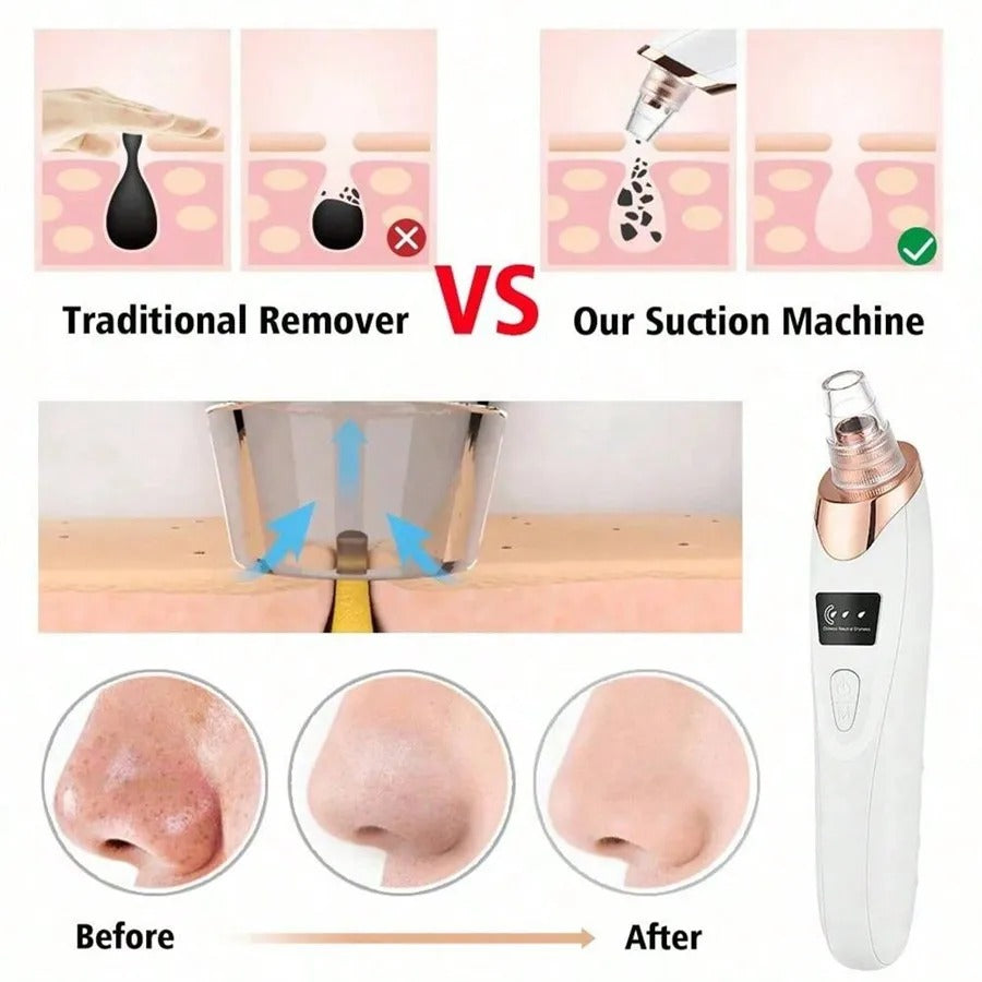 Electric Facial Skin Care Pore Removal Cleanser Vacuum Acne Removal For Deep Facial Pores 5 Suction Power Blackhead Remover Pore
